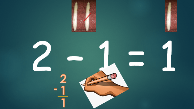 Subtracting numbers up to 20